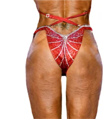 Moderate Back